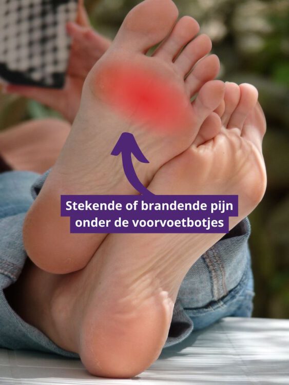 Stekende of brandende pijn onder de voorvoet